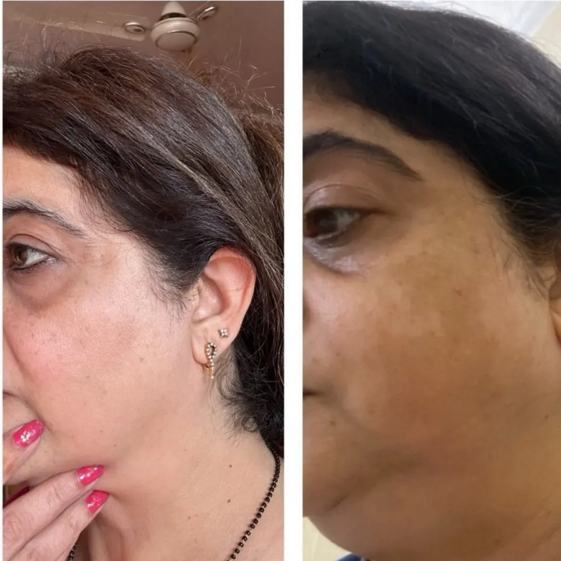 Face Yoga by House of Beauty — Yoga in Vasant Vihar, Delhi